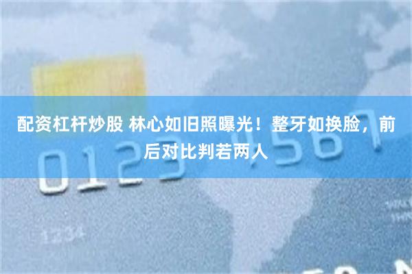 配资杠杆炒股 林心如旧照曝光！整牙如换脸，前后对比判若两人